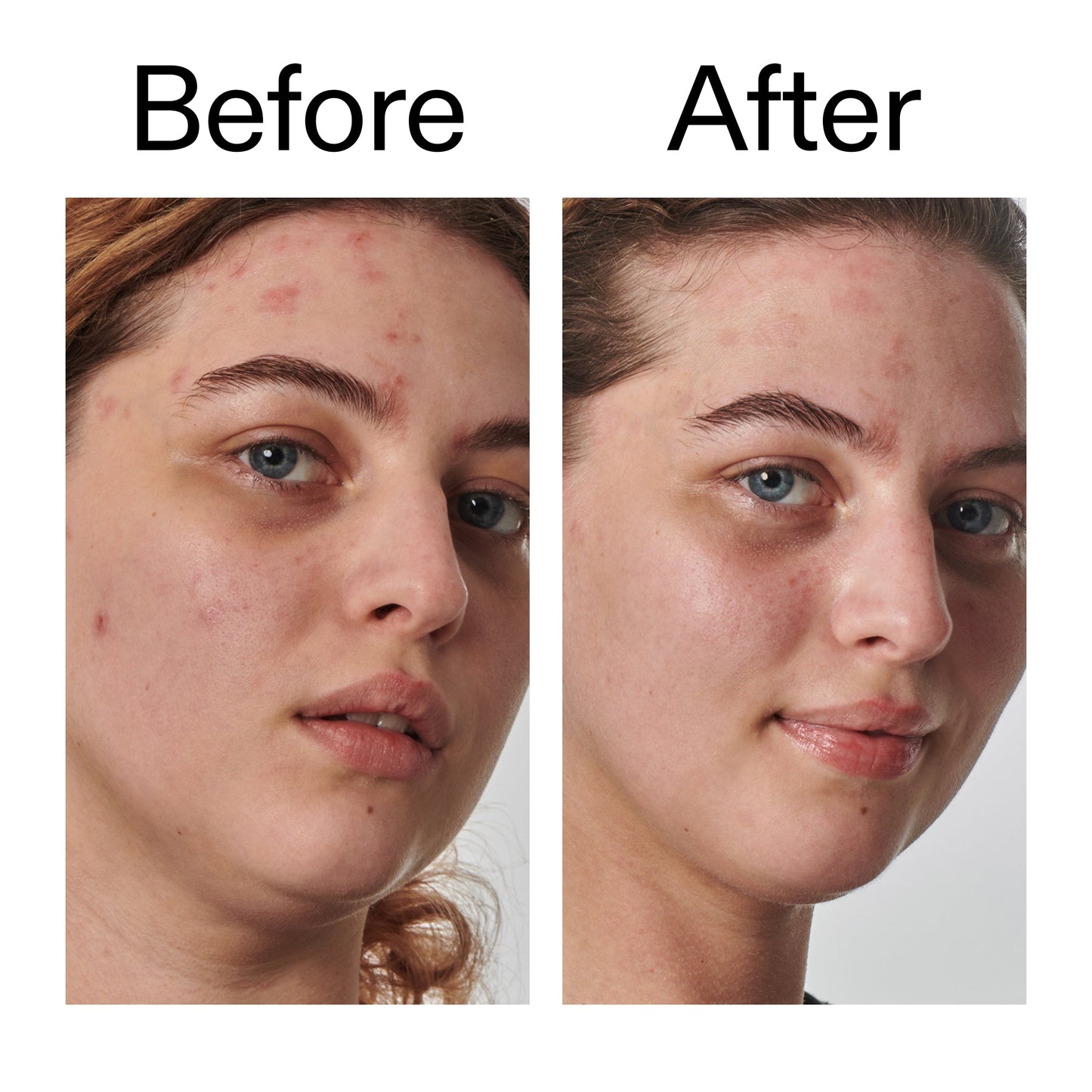 10-urea-moisturizer-x7 Dry_and_Rough_Skin_Solution_Before_After_2000x2000_efa6e639-5c39-49bd-a5dd-f0220293120a.jpg