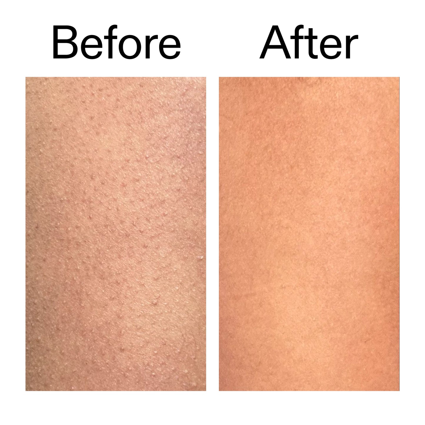 glycolic-acid-exfoliating-body-stick-duo-r9 Glycolic_Body_Stick_B_A_2000x2000_6e6e6b4d-5bd7-43c0-aeed-4d66788e8995.jpg