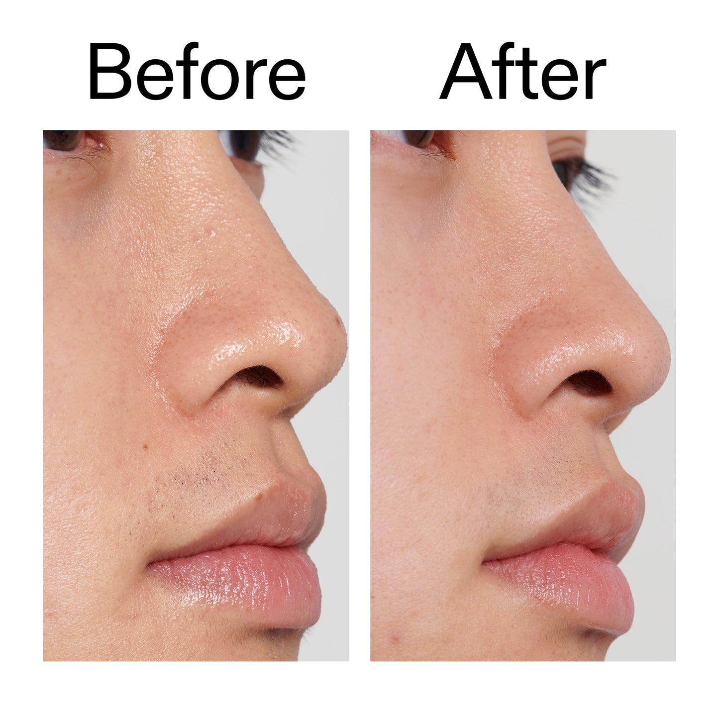 pha-toner-z5 PHA_Toner_Before_After_2000x2000_e3c10172-0150-4342-8b95-57417eaff50d.jpg