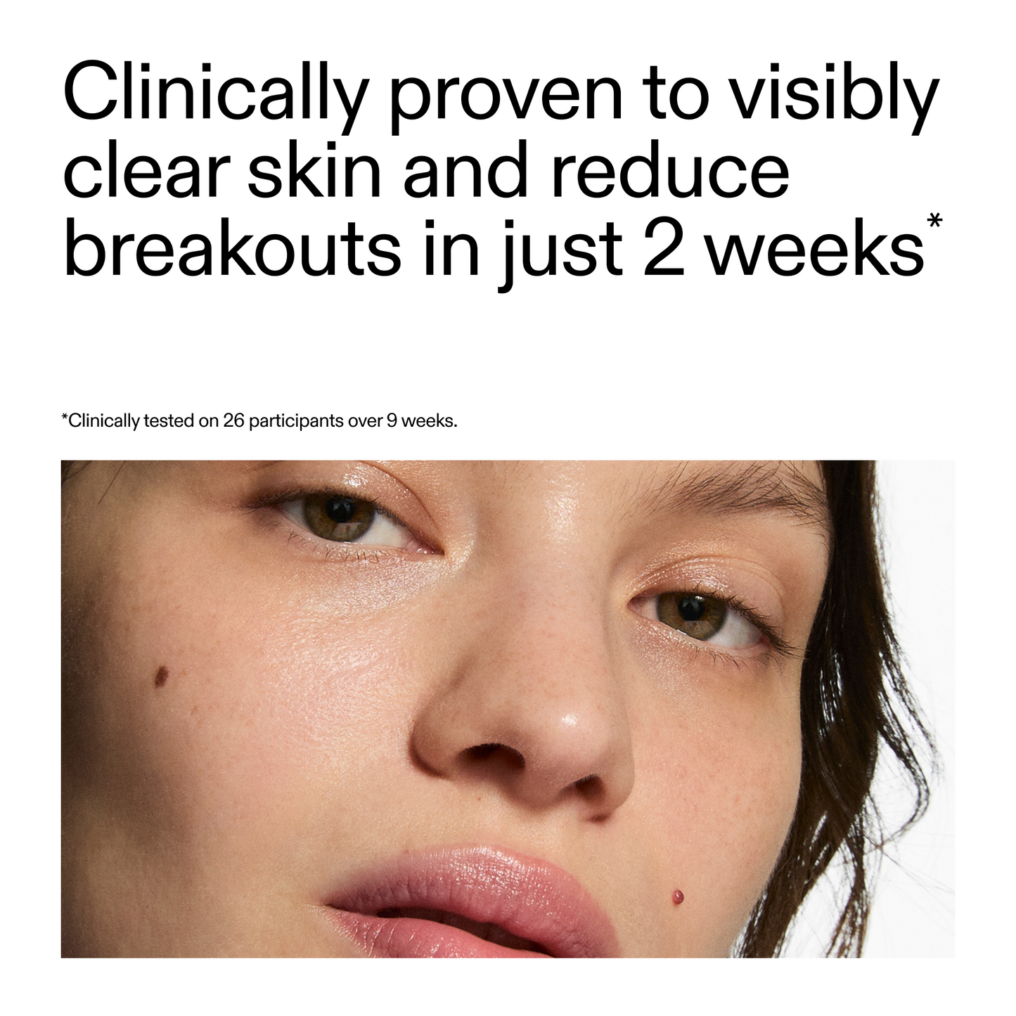 360-acne-clearing-duo-t9 360_Serum_Key_Claim.png