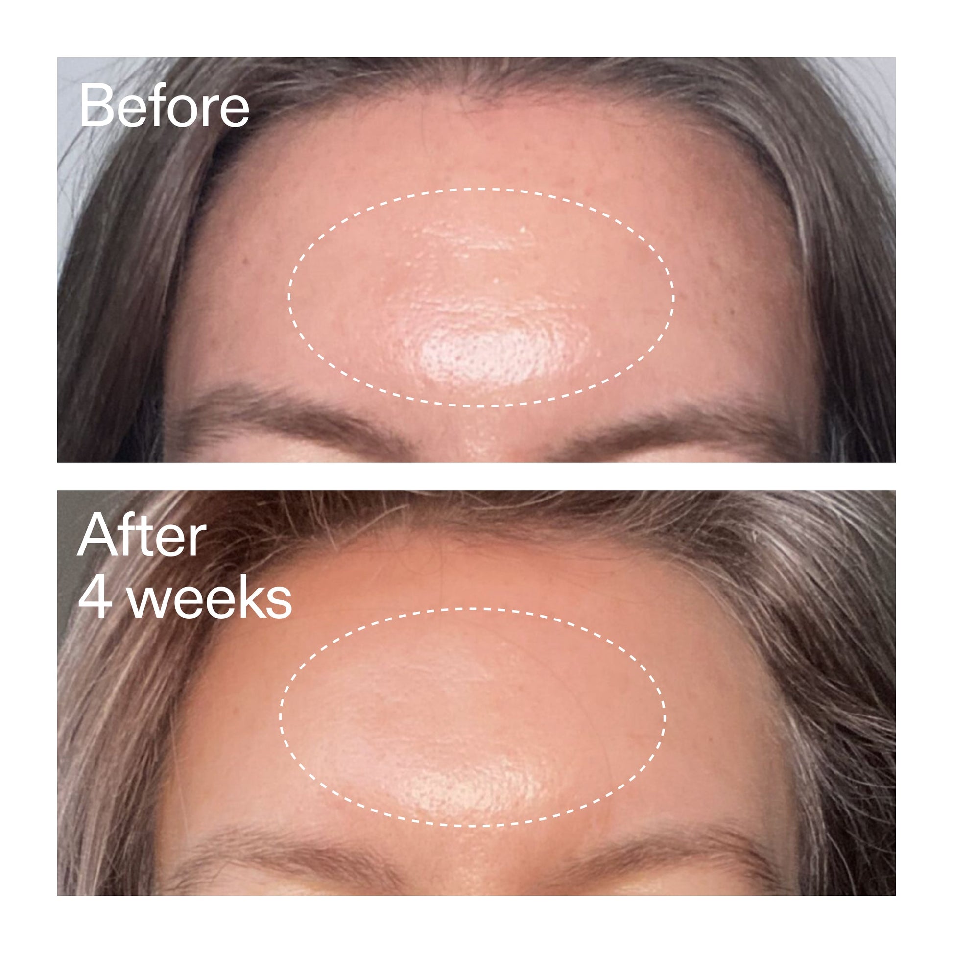 advanced-0-2-retinal-serum-duo-k3 AdvancedRetinal_BeforeAfter1_2000x2000_4e9c798a-f30e-45b8-a34a-7c4740f2f2cb.jpg