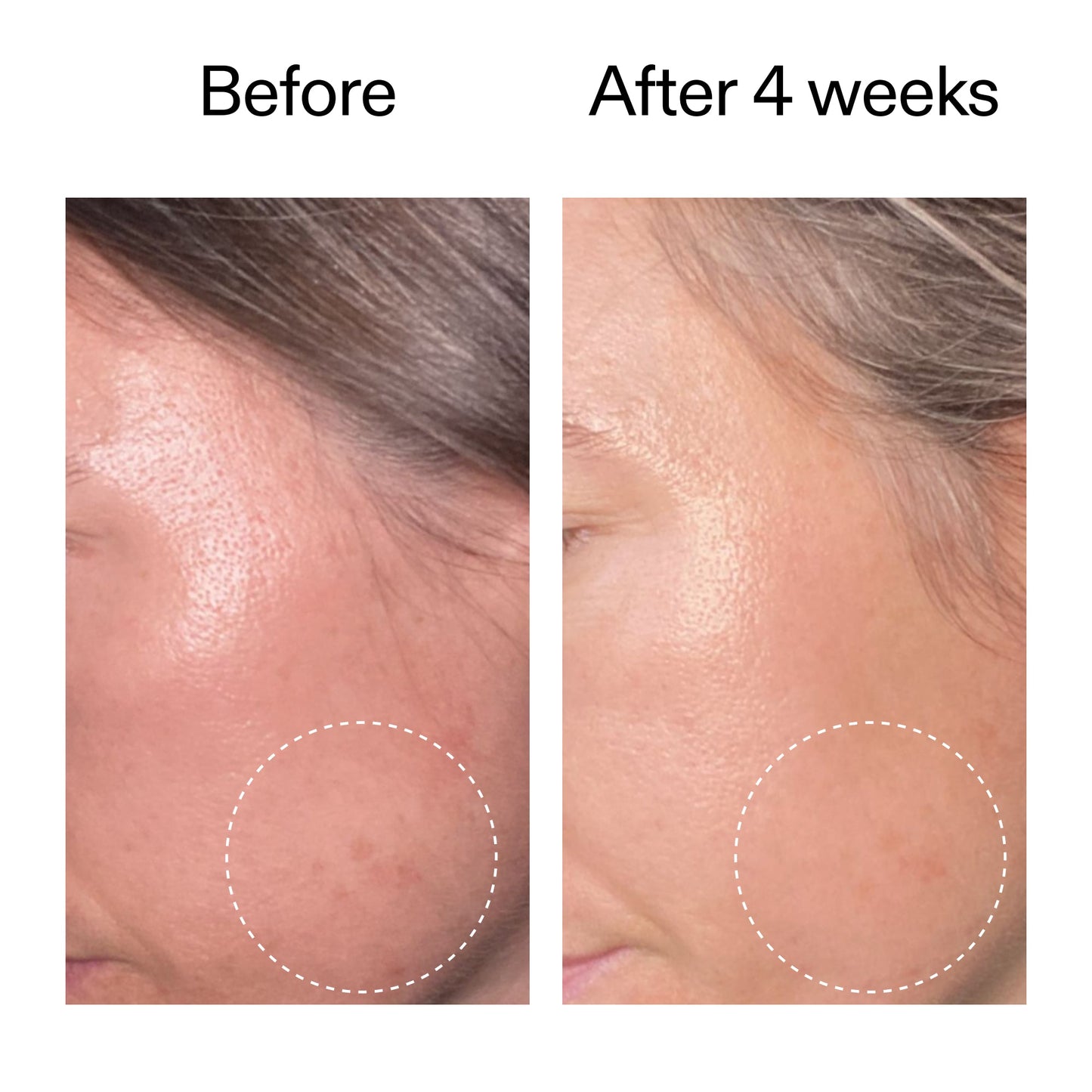 advanced-0-2-retinal-serum-f0 AdvancedRetinal_BeforeAfter2__2000x2000_62fb16bb-77ae-4d63-8500-88dbf847f4b9.jpg