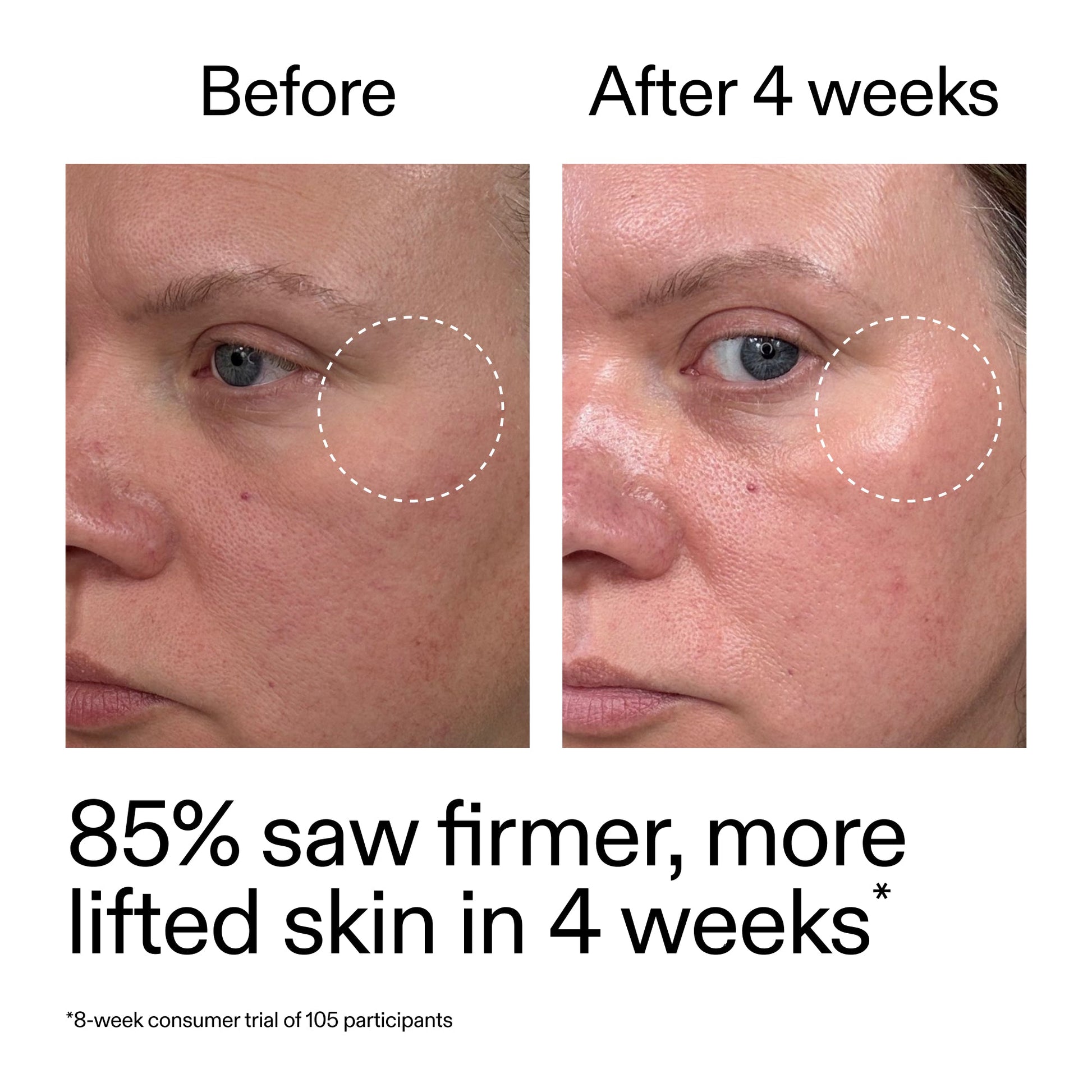 advanced-0-2-retinal-serum-duo-k3 AdvancedRetinal_BeforeAfter_Claim1_2000x2000_3a315aa8-f408-4b33-bbeb-0d9209f98404.jpg