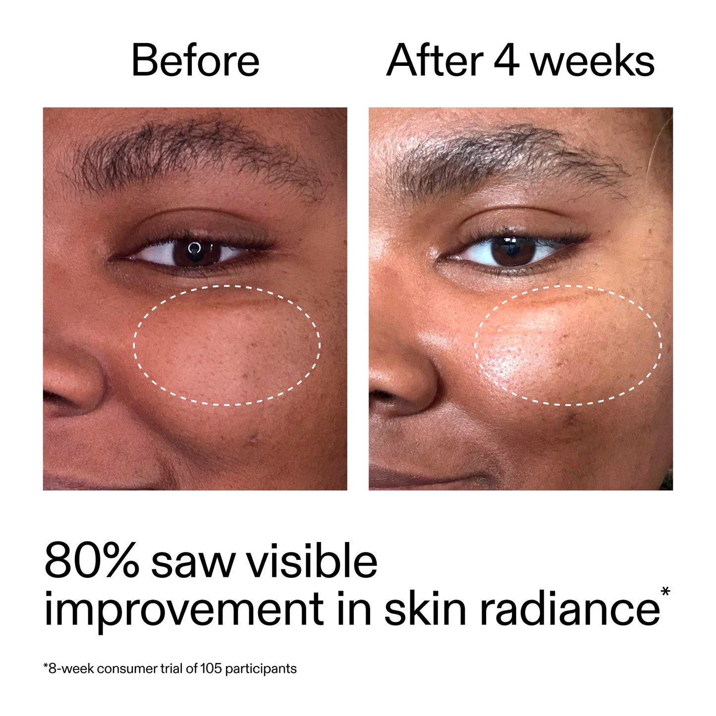 advanced-0-2-retinal-serum-f0 AdvancedRetinal_BeforeAfter_Claim2_2000x2000_39d11e3d-eda9-44ec-ab32-2903b1a368bd.jpg