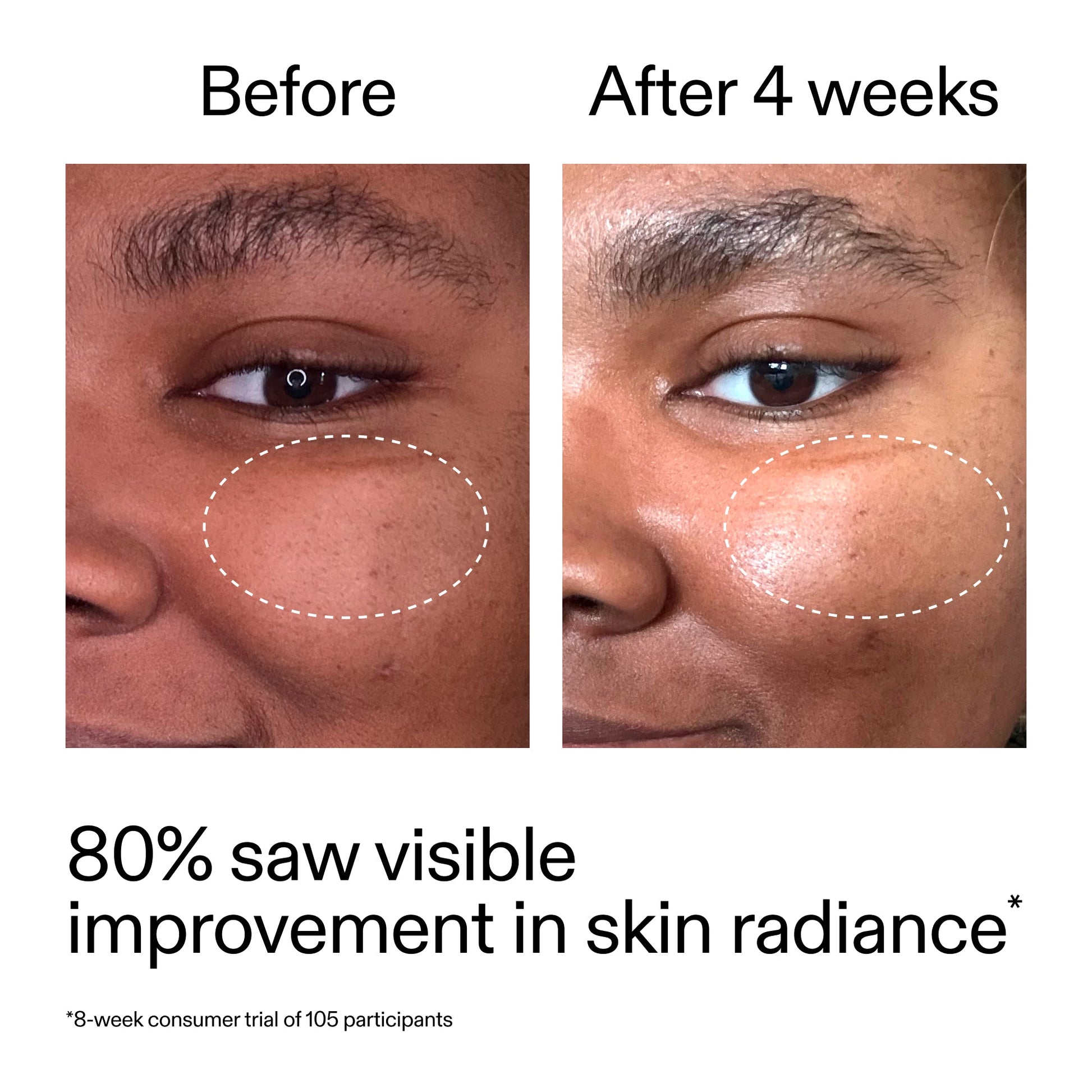 advanced-0-2-retinal-serum-f0 AdvancedRetinal_BeforeAfter_Claim2_2000x2000_39d11e3d-eda9-44ec-ab32-2903b1a368bd.jpg