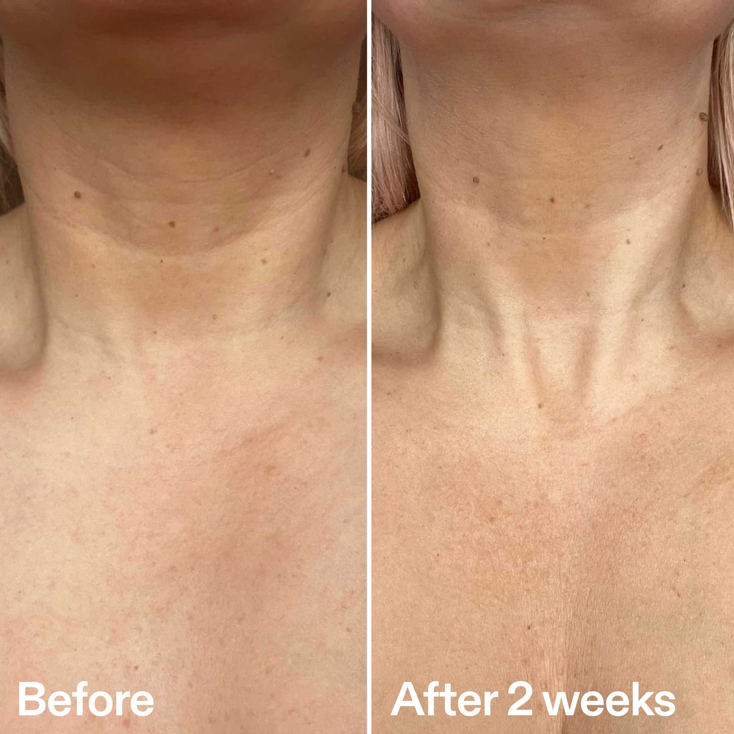 bio-active-neck-lift-stick-b5 B_A_2.jpg