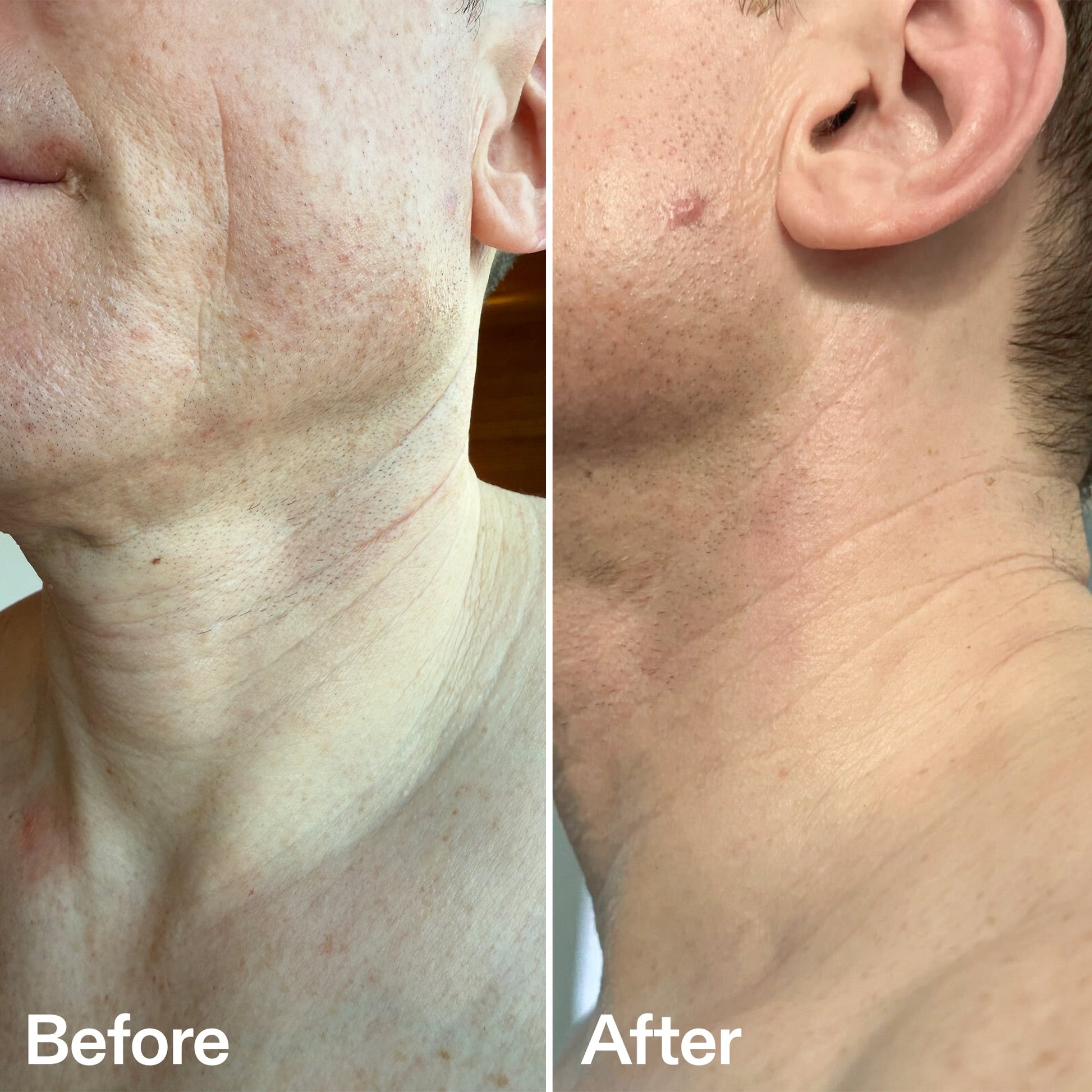 bio-active-neck-lift-stick-b5 B_A_afa2743e-b8e2-4504-92f4-e281cb6cf759.jpg