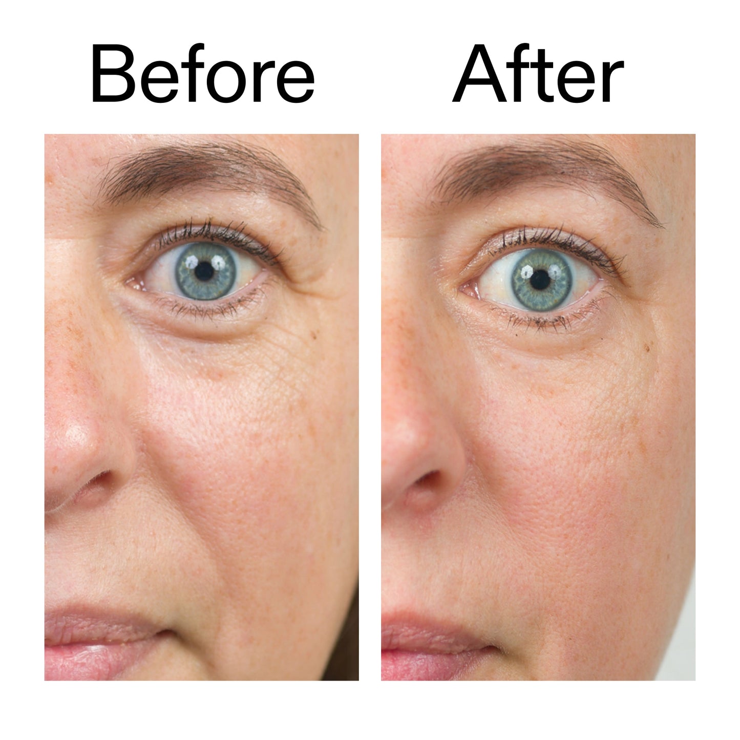bio-active-ceramide-moisturizer-duo-x0 Bio-Active_Before_After_2000x2000_566e5a9e-135e-417a-8242-b44e5fa35463.jpg