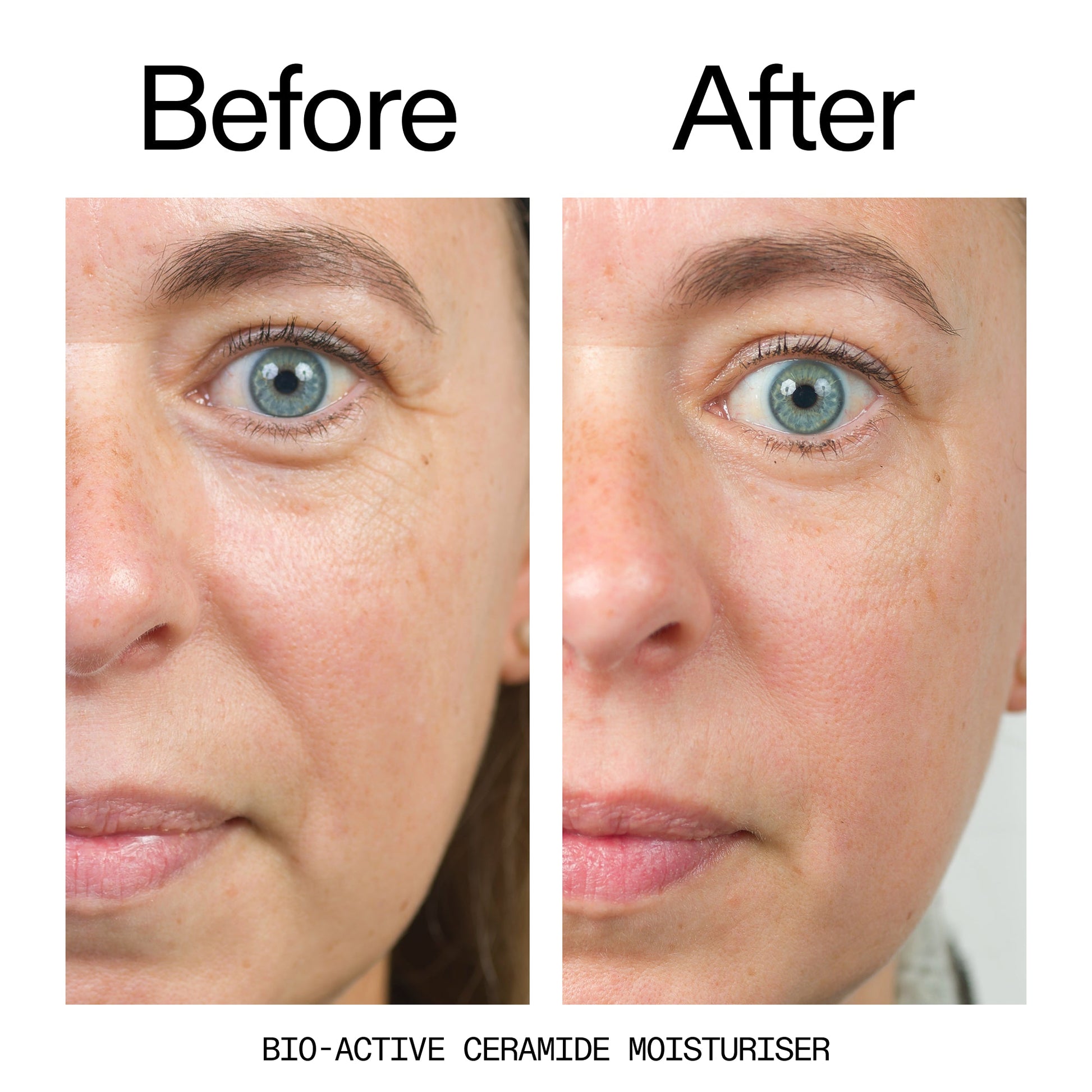 barrier-boosting-trio-z4 Bio-Active_Before_After_2000x2000_600947b4-e8c5-425a-9155-fc15bc83aa12.jpg