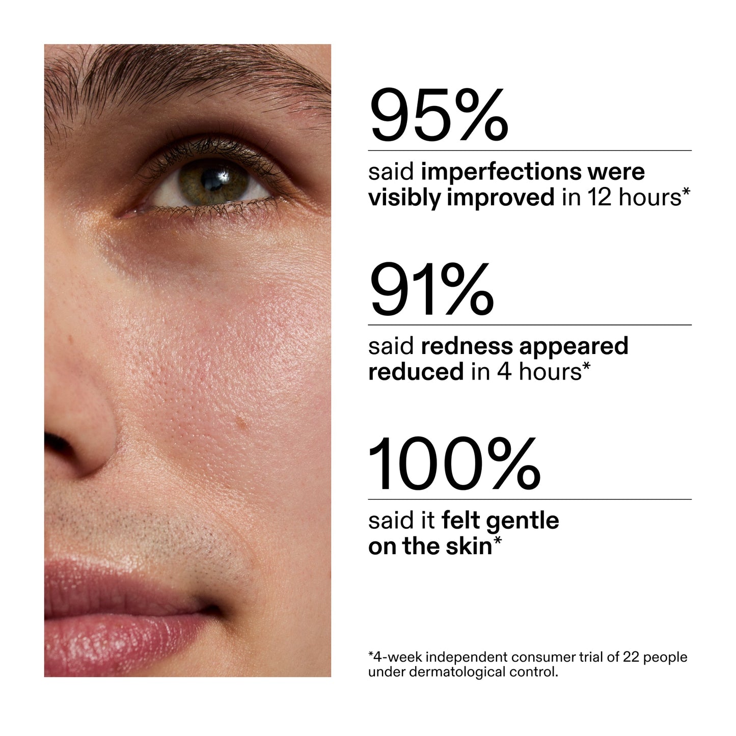 succinic-acid-acne-treatment-c4 CA_Succinic_Acid_Treatment_key_Claims_2000x2000_db91b0f1-7f29-4bfe-bb16-63a47f500960.jpg