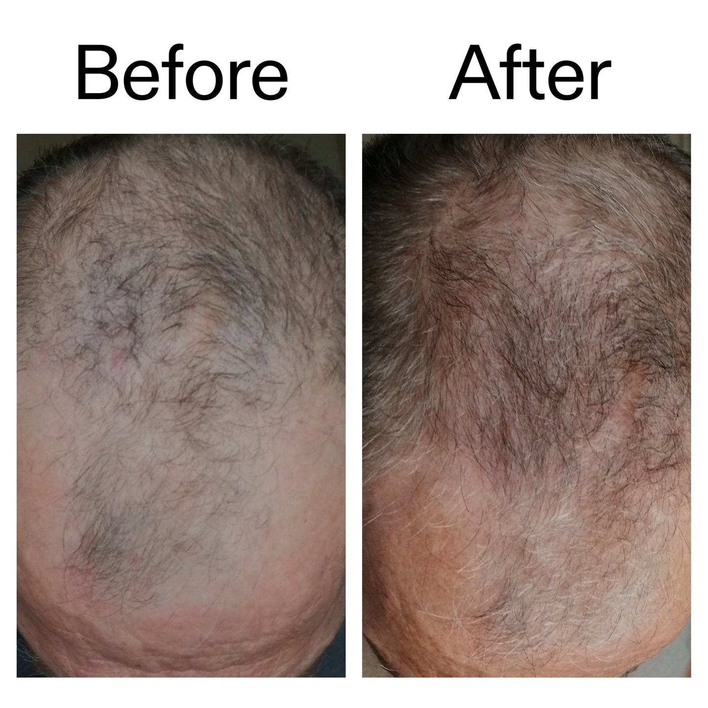 3-month-hair-growth-trio-m0 Caffeine_Scalp_Treatment_B_A_Ppage_2000_x_2000.jpg