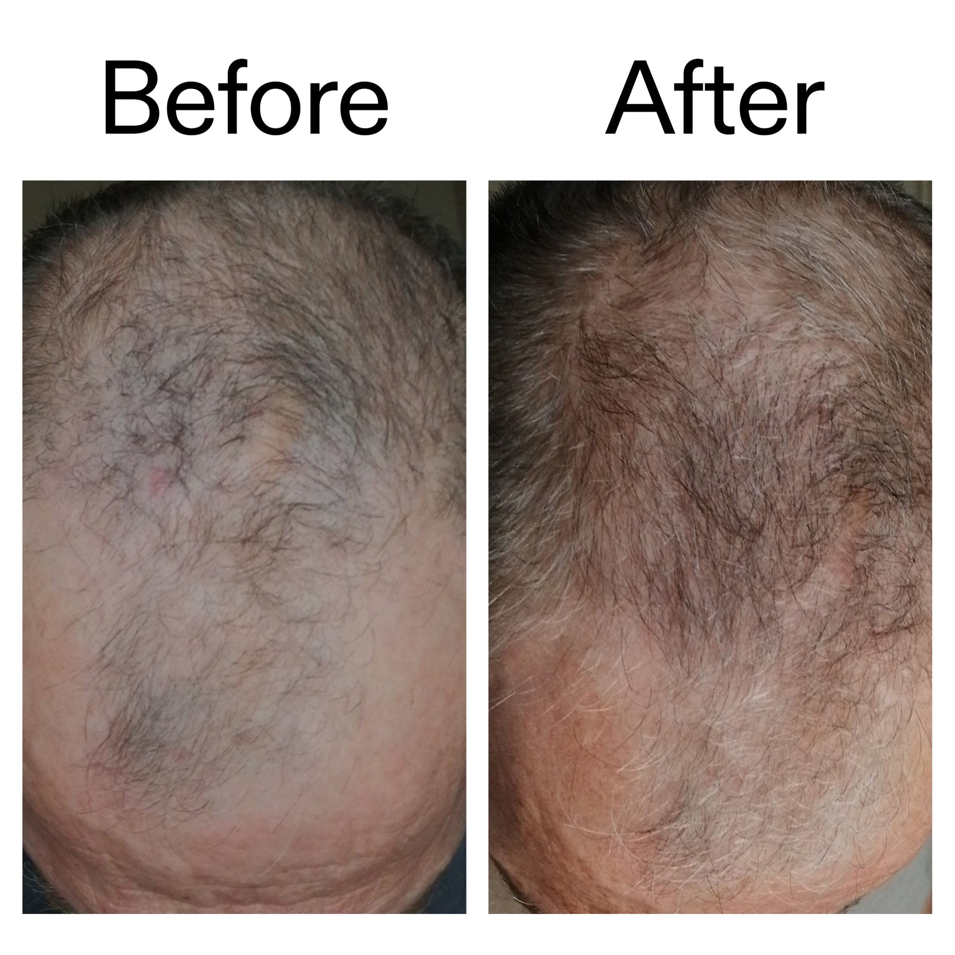 caffeine-stimulating-scalp-treatment-t2 Caffeine_Scalp_Treatment_B_A_Ppage_2000_x_2000.jpg
