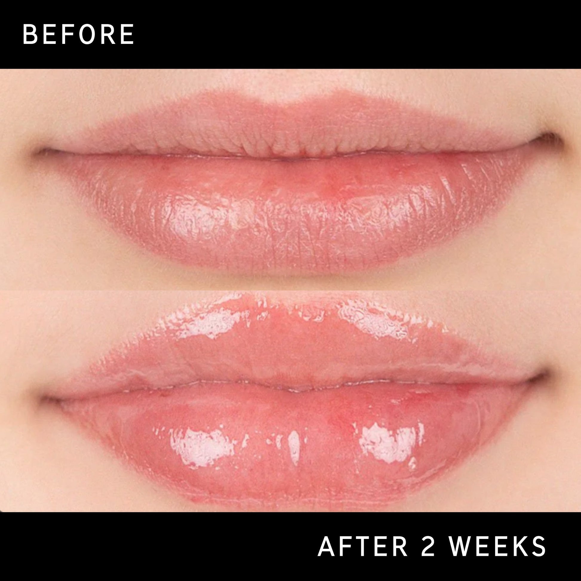 lip-plumping-duo-e3 DTC-Top15_Amends_Tripeptide-Lip_B_A.jpg