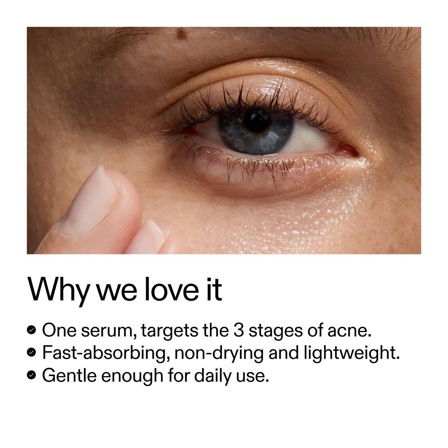 360-acne-clearing-serum-c8 Dioic_Whyweloveit_2000x2000_175aafd3-0cbe-403a-b317-a8362881bfe2.jpg