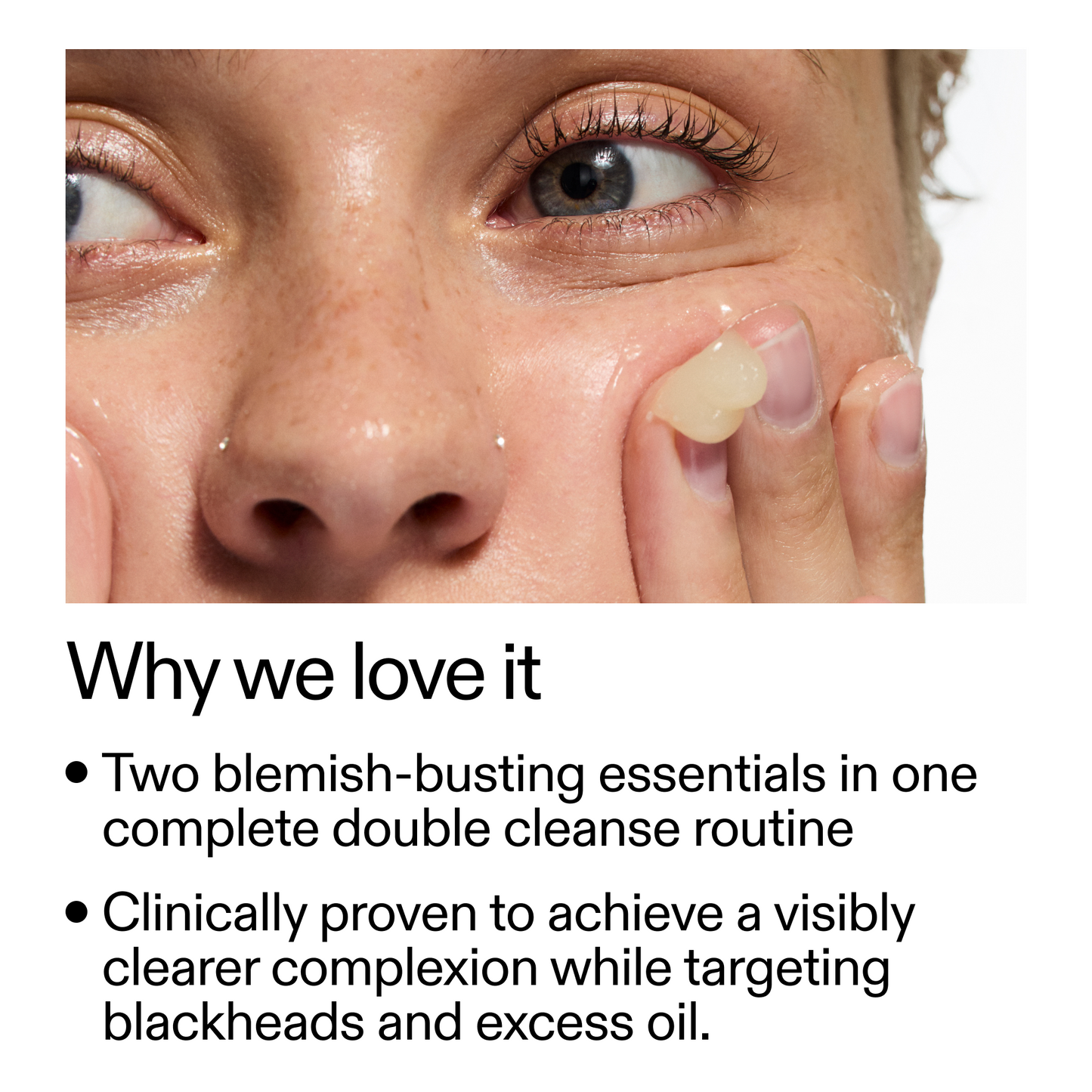 acne-double-cleanse-duo-k2 Double_Cleanse_Duo_for_Breakouts_Why_We_2000x2000_f242cb12-bb5c-487c-b203-071ccb406ec5.png