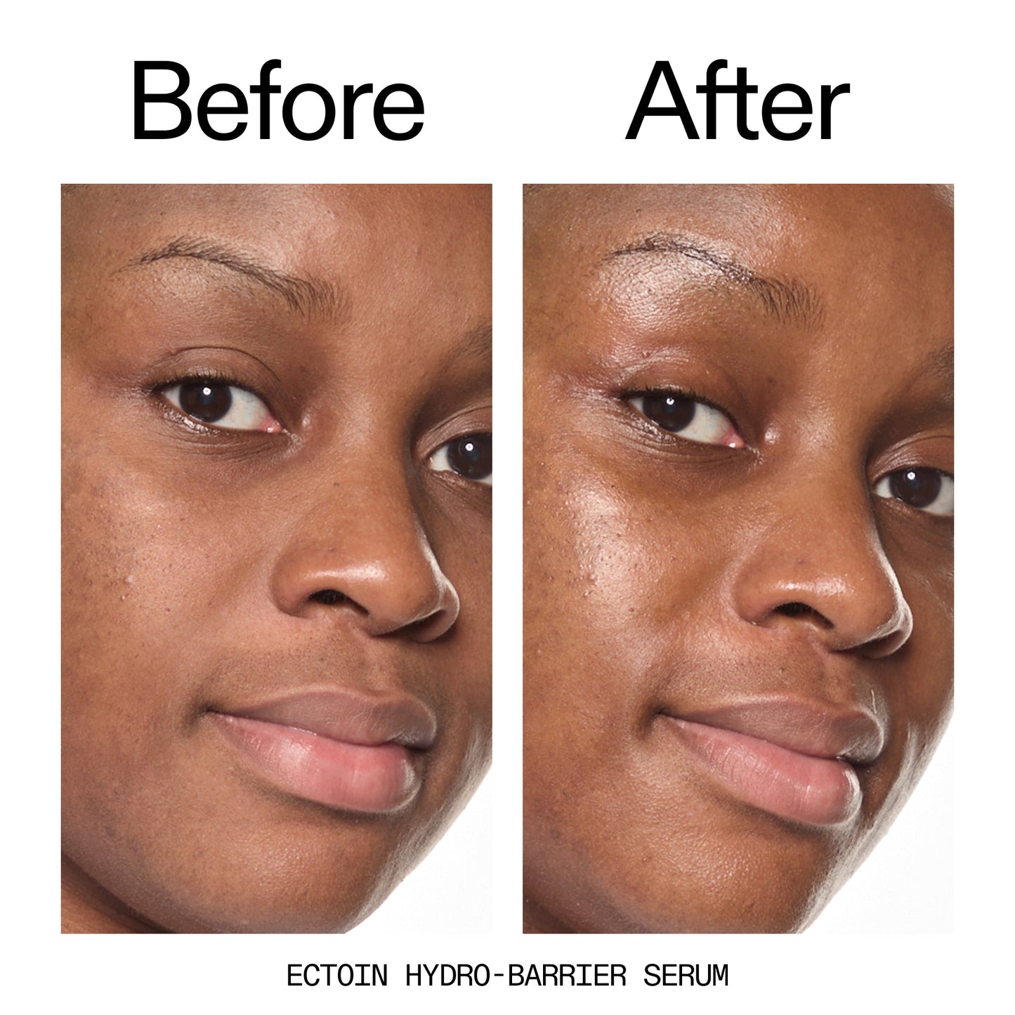 barrier-boosting-trio-z4 Ectoin_Before_After_2000x2000_ce35bc41-4da0-4b6f-adc7-29f8641f6c6c.jpg