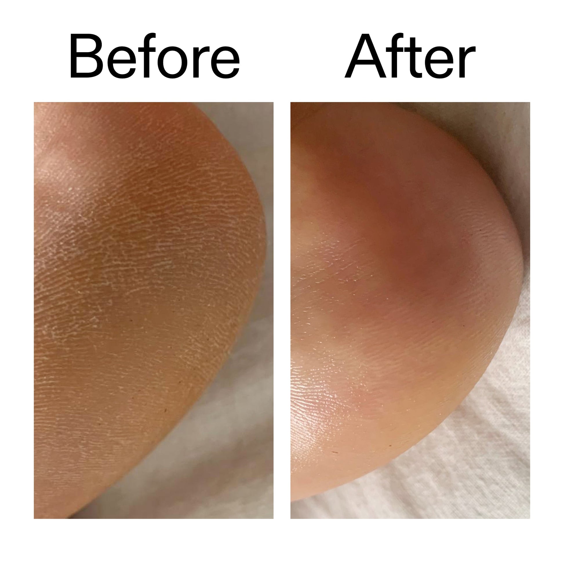 glycolic-acid-exfoliating-body-stick-c7 Glycolic_Acid_Exfoliating_Body_Stick_Before_After_V1_2000x2000_a3043625-9400-429a-a7fb-d6dbd220f722.jpg