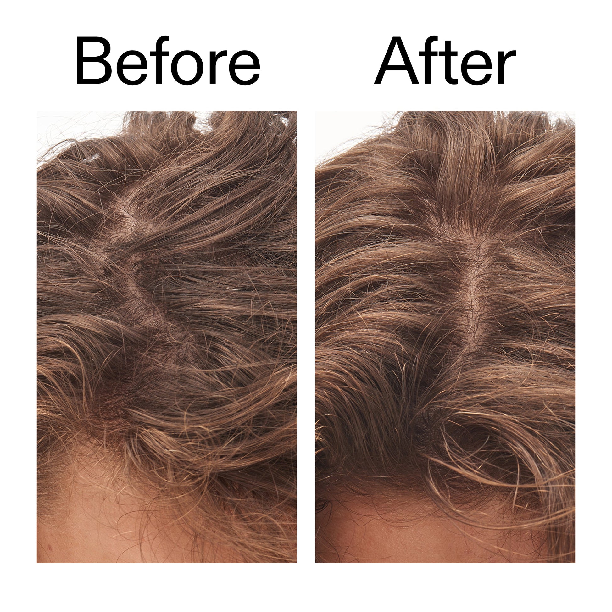 glycolic-acid-exfoliating-scalp-scrub-n2 Glycolic_Acid_Exfoliating_Scalp_Scrub_Before_After_2000x2000_b8561c87-05a1-4caa-80f7-1b6b33d750f7.jpg