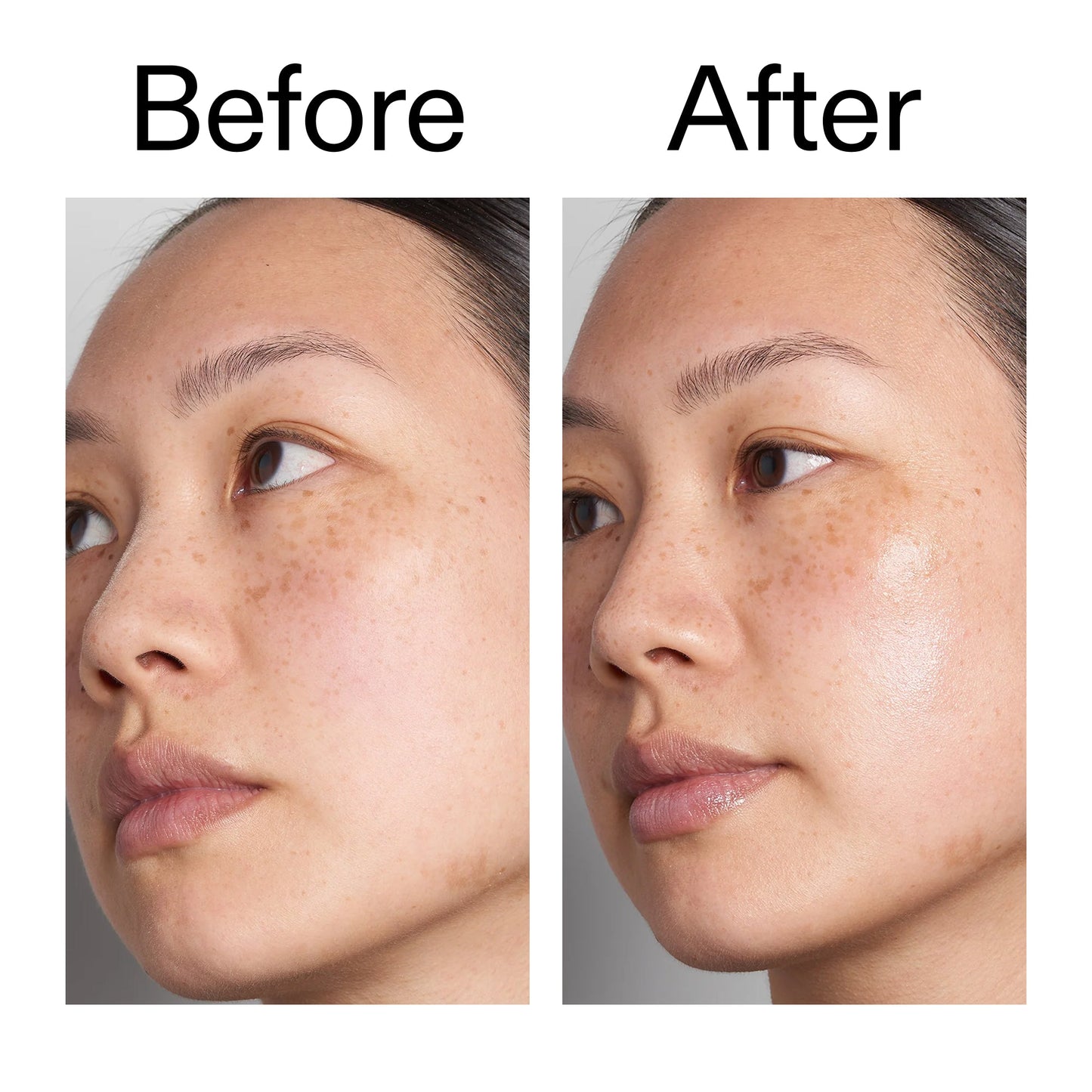 supersize-hyaluronic-acid-serum-100ml-b5 Hyaluronic_Acid_Before_After_2000x2000_d7983956-8aa2-4ea3-8255-c63e8d4f892e.jpg