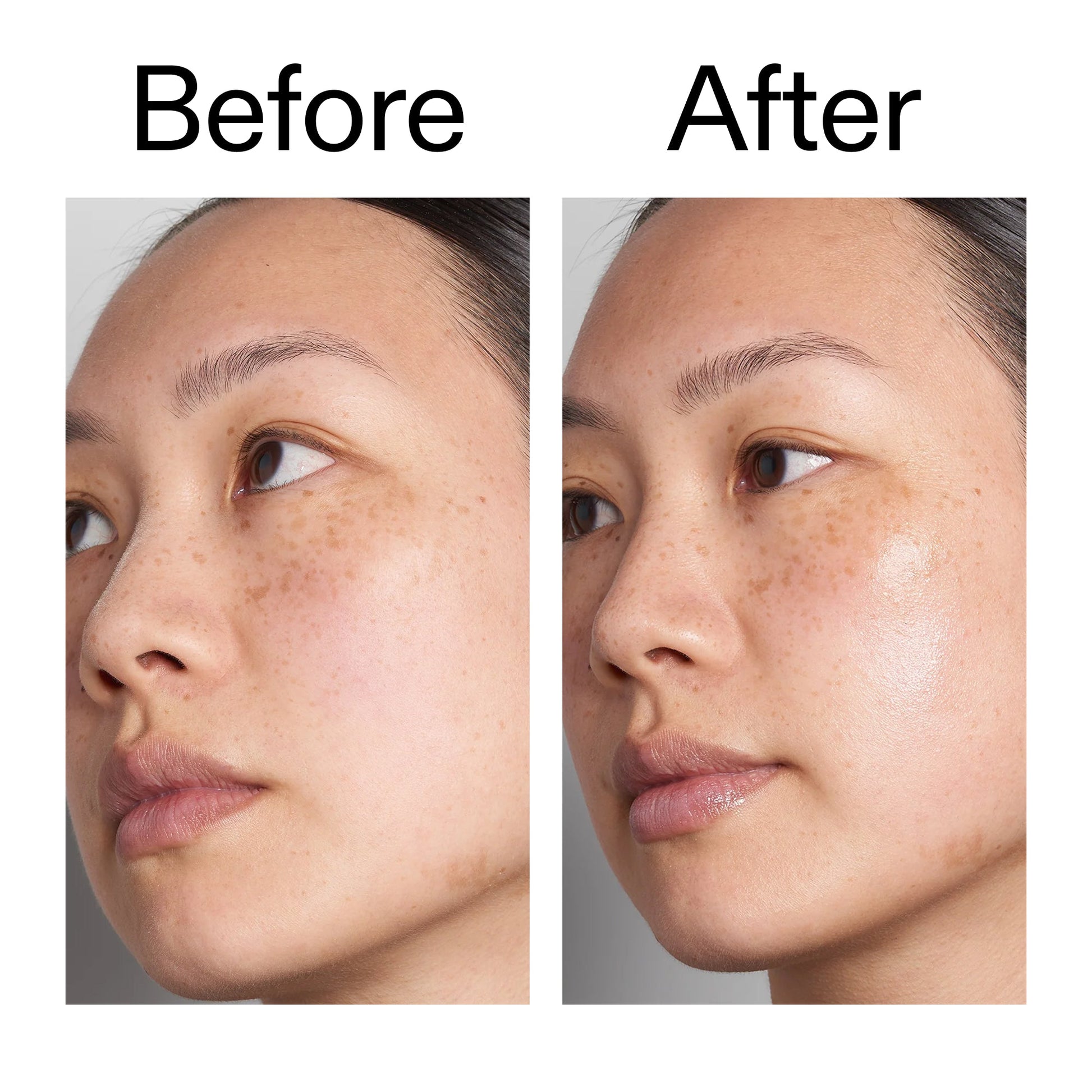 supersize-hyaluronic-acid-serum-100ml-b5 Hyaluronic_Acid_Before_After_2000x2000_d7983956-8aa2-4ea3-8255-c63e8d4f892e.jpg