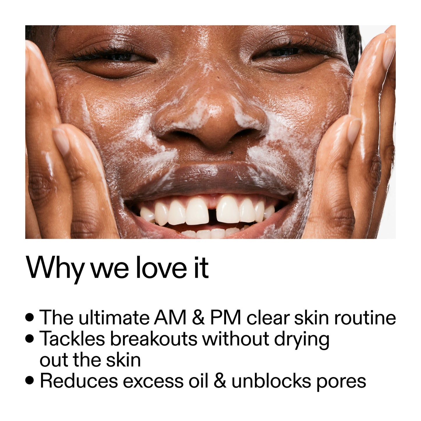 intro-routine-for-acne-q9 Intro_Routine_for_Acne_Why_we_love_it_2000x2000_42499e10-4629-4a0e-a627-7e215f4da6bc.jpg