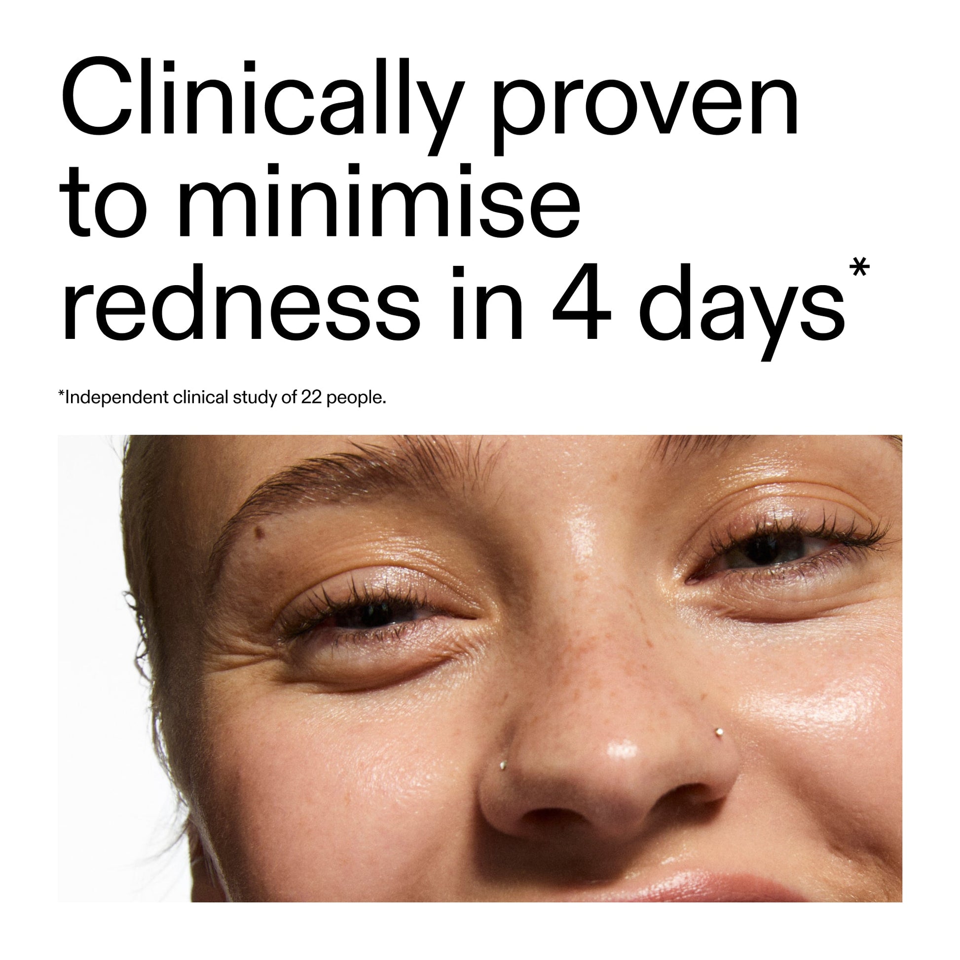 10-azelaic-acid-serum-for-redness-relief-v1 Oat_Cleansing_Balm_Claim_2000x2000_52a841dc-353c-4f2c-8646-3aadb604507d.jpg
