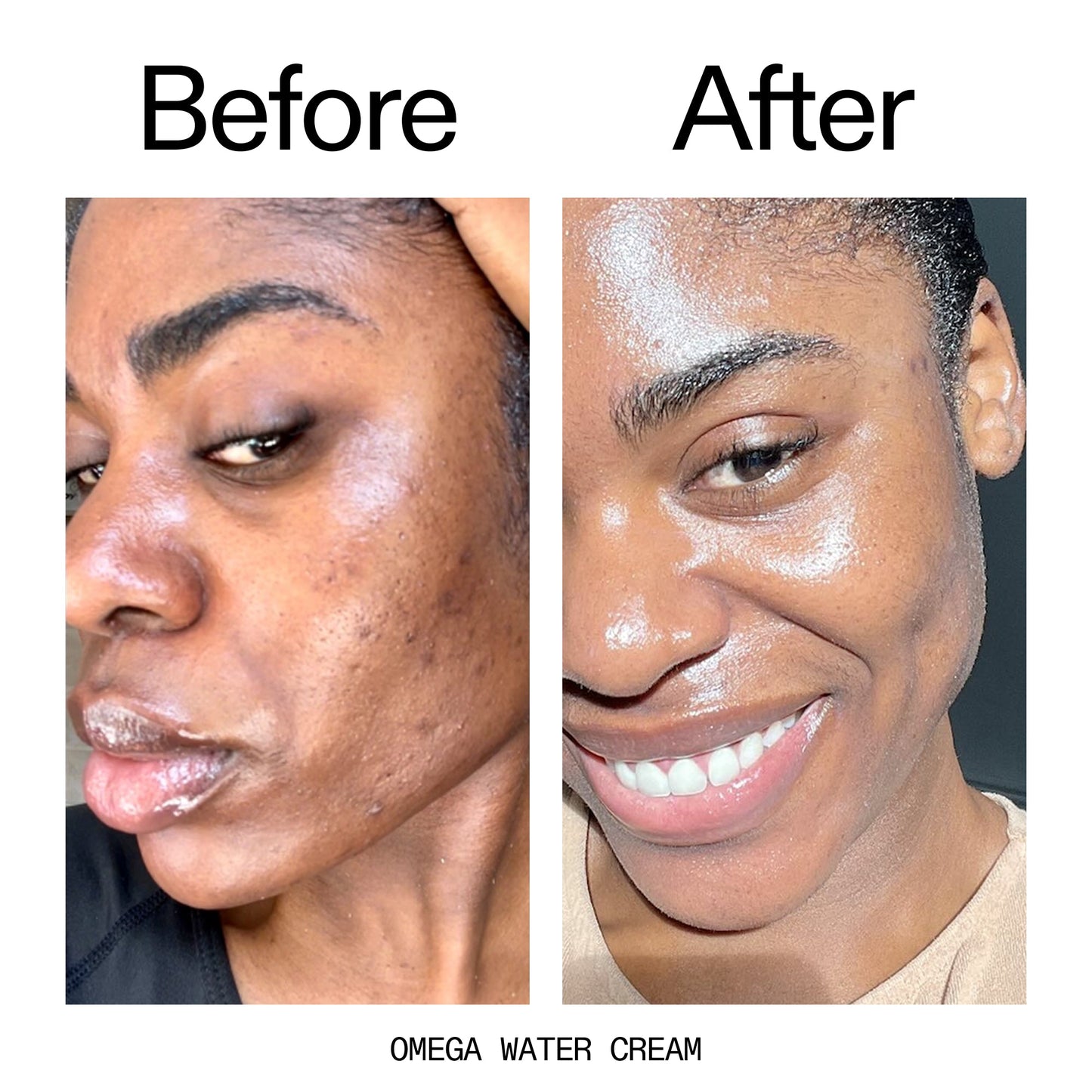glowing-skin-set-o7 Omega_Water_Cream_Before_After_2000x2000_8e88278b-8c8d-48dc-ac77-4e98ebbd1b77.jpg