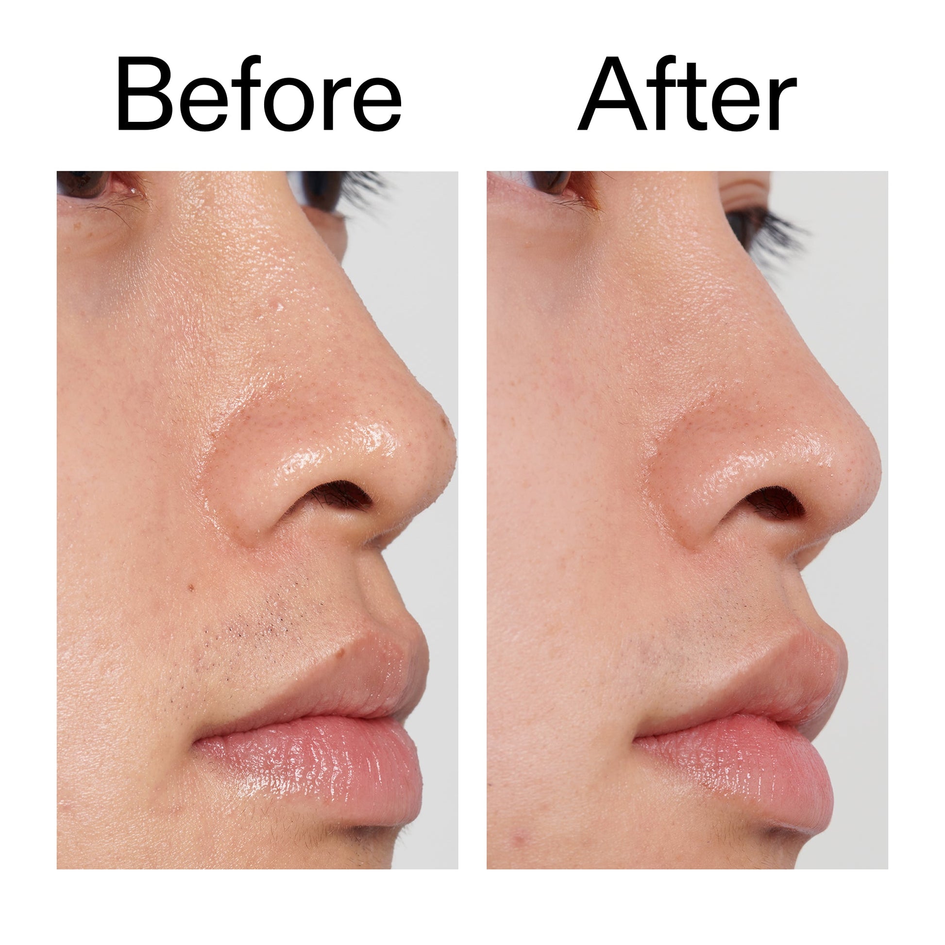 pha-toner-z5 PHA_Toner_Before_After_2000x2000_e3c10172-0150-4342-8b95-57417eaff50d.jpg