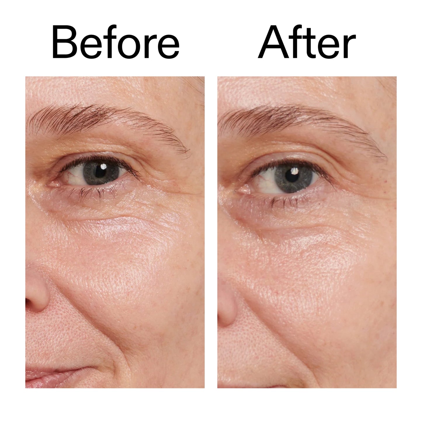 retinol-eye-cream-g6 Retinol_Eye_Cream_Before_After_2000x2000_ac03a80c-109e-4572-a95a-91dc109b4d27.jpg