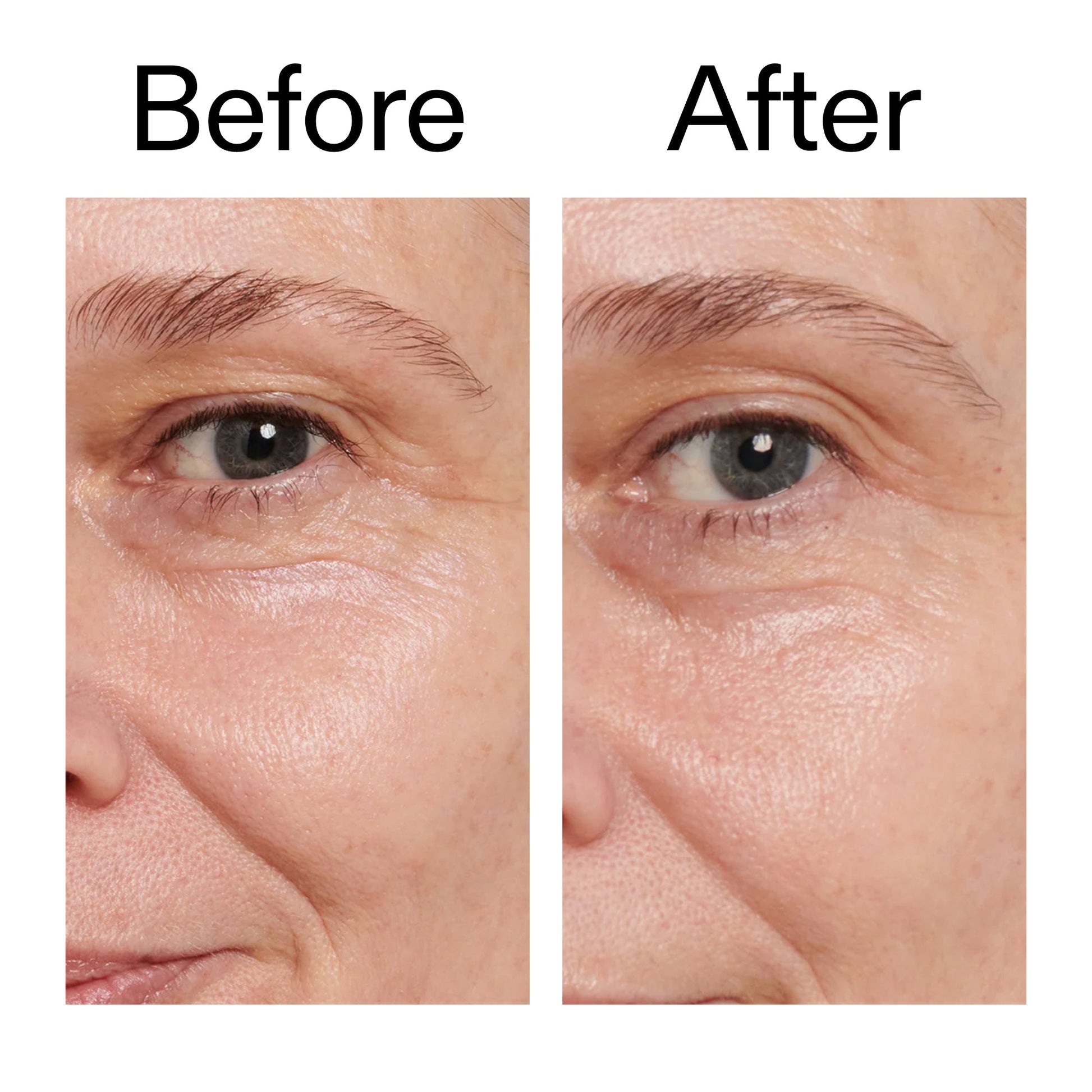 retinol-eye-cream-g6 Retinol_Eye_Cream_Before_After_2000x2000_ac03a80c-109e-4572-a95a-91dc109b4d27.jpg