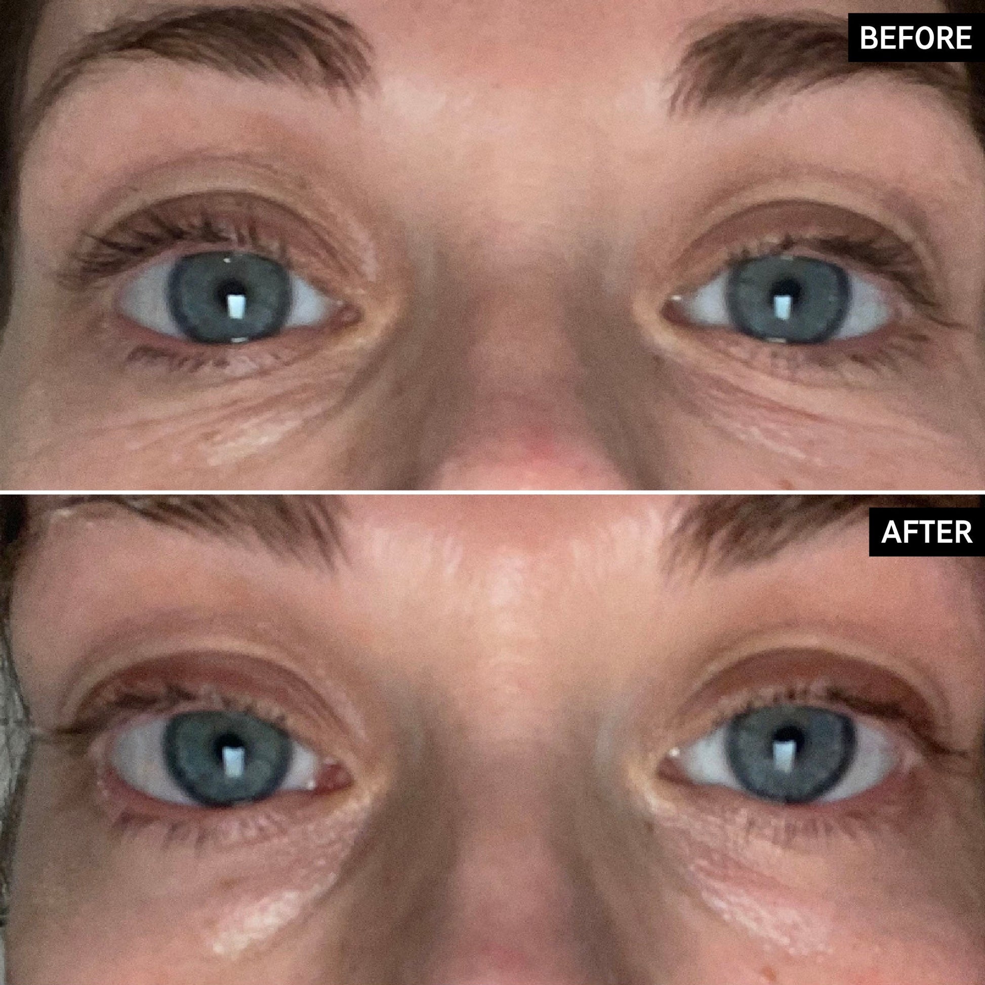 retinol-eye-cream-g6 SITE-UGCBAsApril_Nicole_B_A_PPage_2000x2000_1.jpg