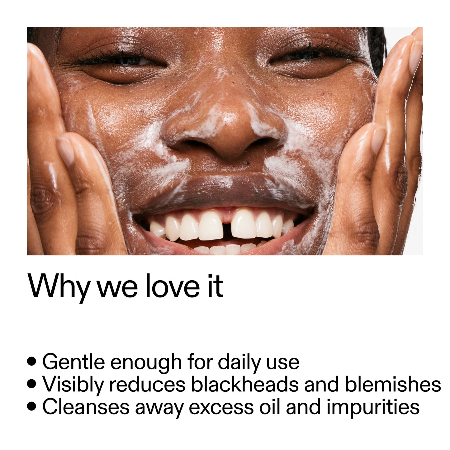 salicylic-acid-cleanser-150ml-a3 Salicylic_Acid_Cleanser_-_300mlWhy_we_love_it_2000x2000_87dc92a9-2559-4309-98cd-4e570f1be735.jpg
