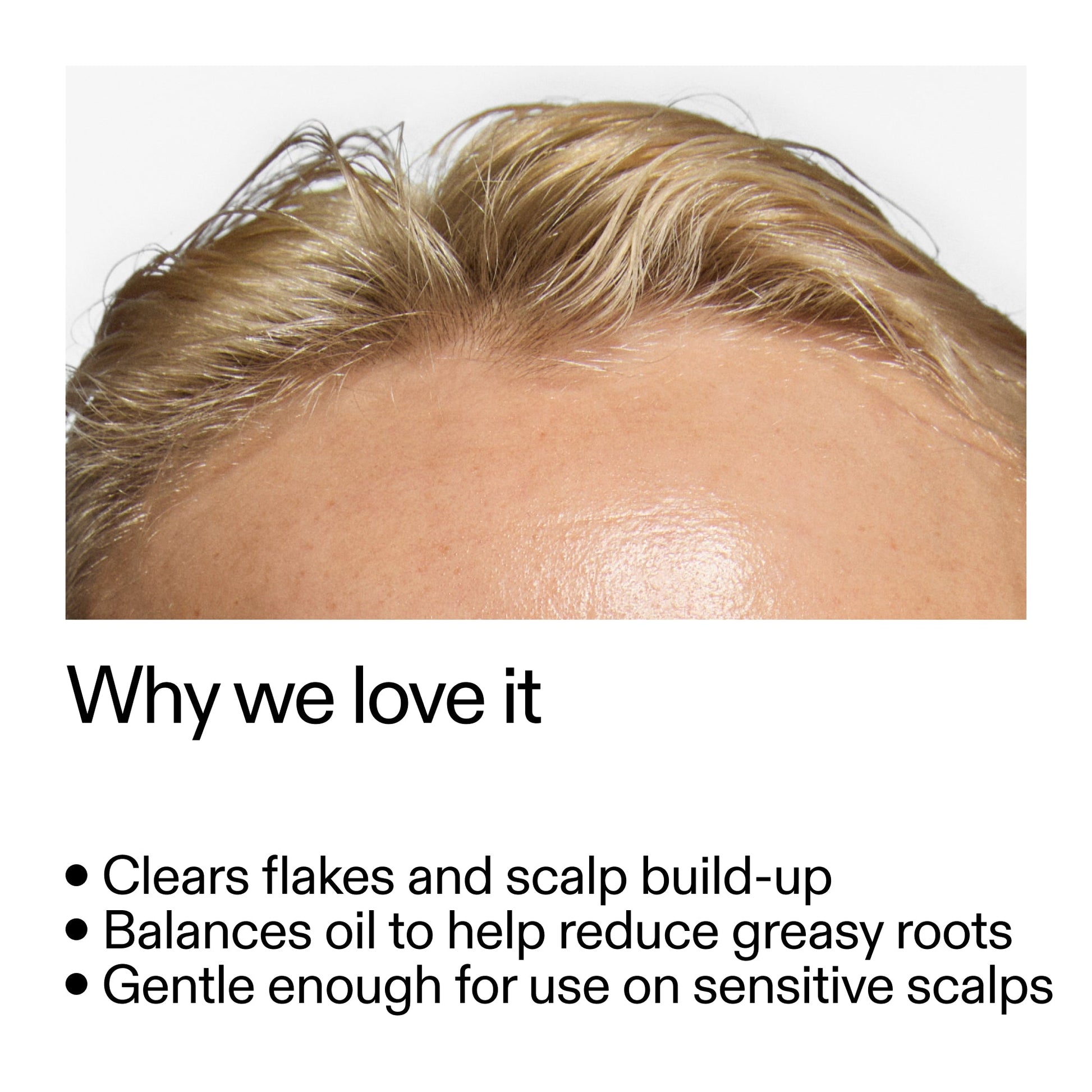 salicylic-acid-exfoliating-scalp-treatment-y4 Salicylic_Acid_Exfoliating_Scalp_Treatment_Why_we_love_it_2000x2000_44b6bd6d-9ec4-4b23-9dc4-bc3fd6f28e14.jpg