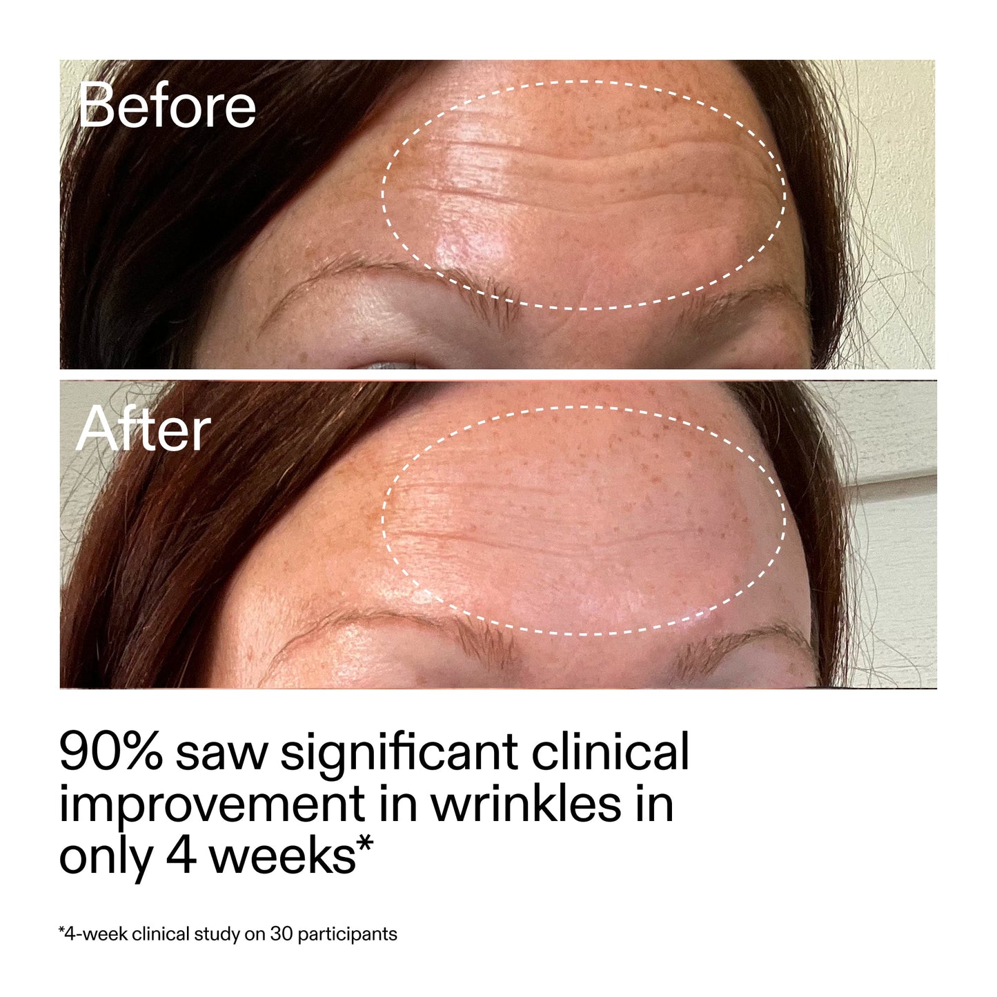 starter-retinol-serum-duo-c2 StarterRetinol_BeforeAfter_Claim1_2000x2000_03b4d6e5-a357-43b9-a855-aba5e35c57f3.jpg