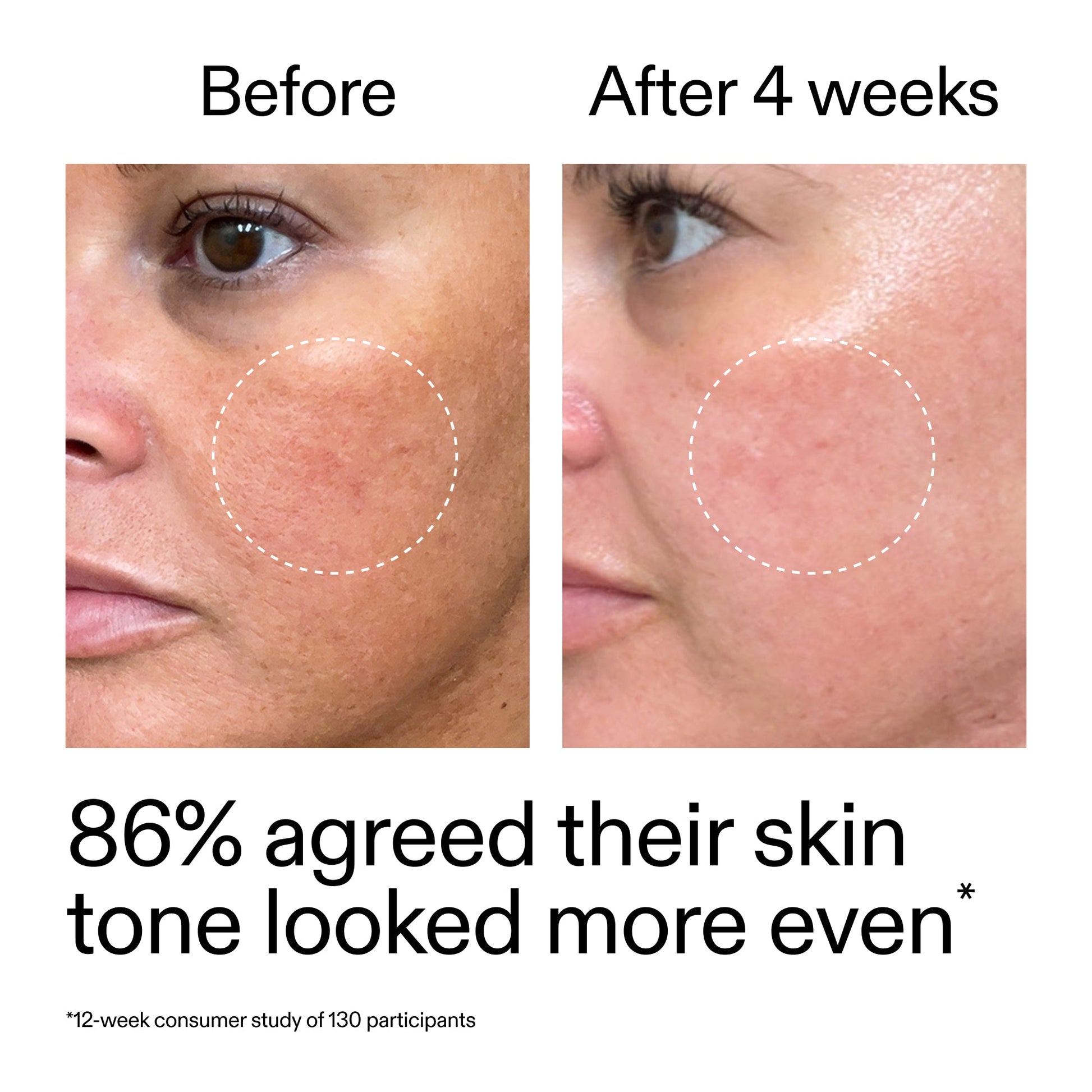 starter-retinol-serum-r0 StarterRetinol_BeforeAfter_Claim2_2000x2000_f5c9ecc0-8d76-429d-bef5-c3a61bcf5c09.jpg