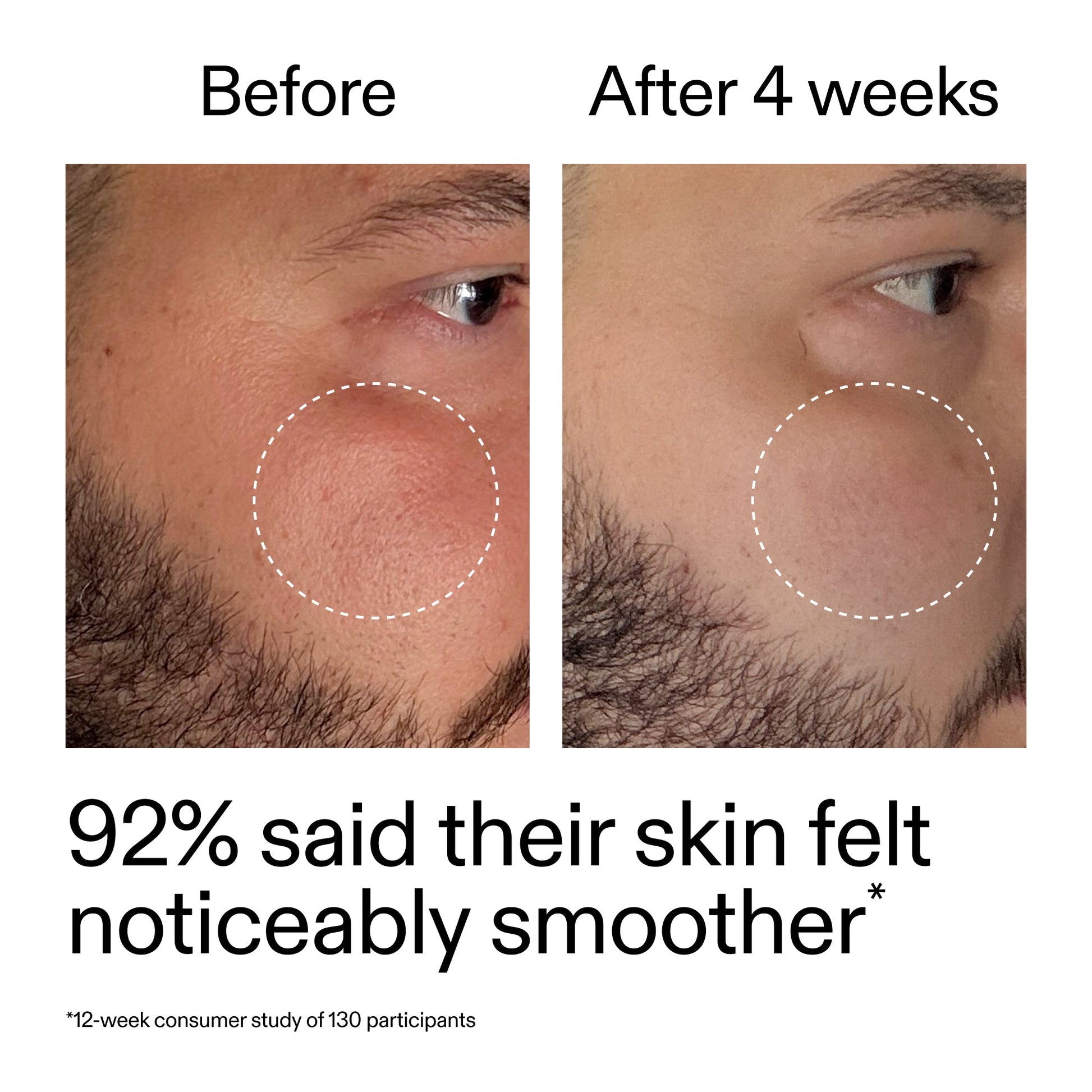 starter-retinol-serum-r0 StarterRetinol_BeforeAfter_Claim3_2000x2000_6ceab106-e0ee-4ed4-ba62-41bc39538038.jpg
