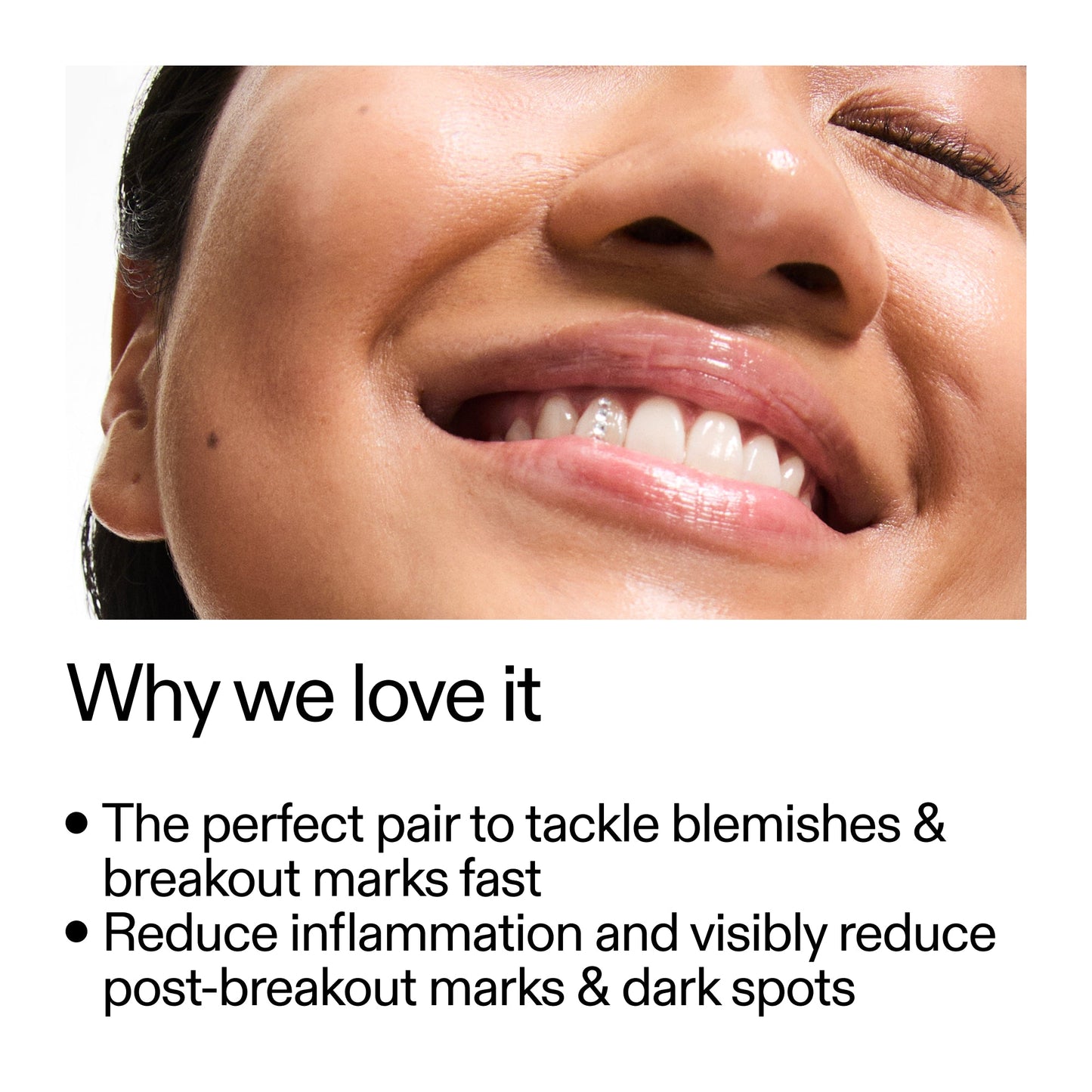 targeted-blemish-duo-e0 Targeted_Blemish_Duo_Why_we_love_it_2000x2000_ff00be46-438b-485f-b5c3-91e60bbb6919.jpg