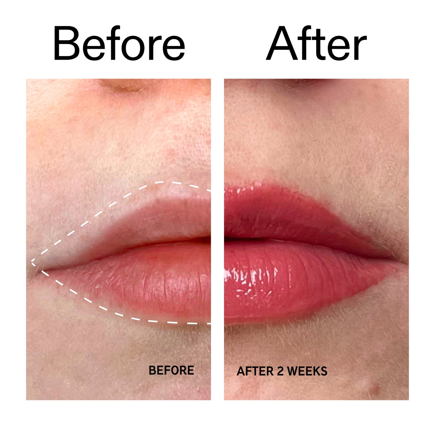 tripeptide-plumping-berry-lip-balm-s0 Tripeptide_Plumping_Lip_Balm_-_Berry_Before_After_2000x2000_9474bbd8-43ca-4b0e-b0e7-dfab70b91927.jpg