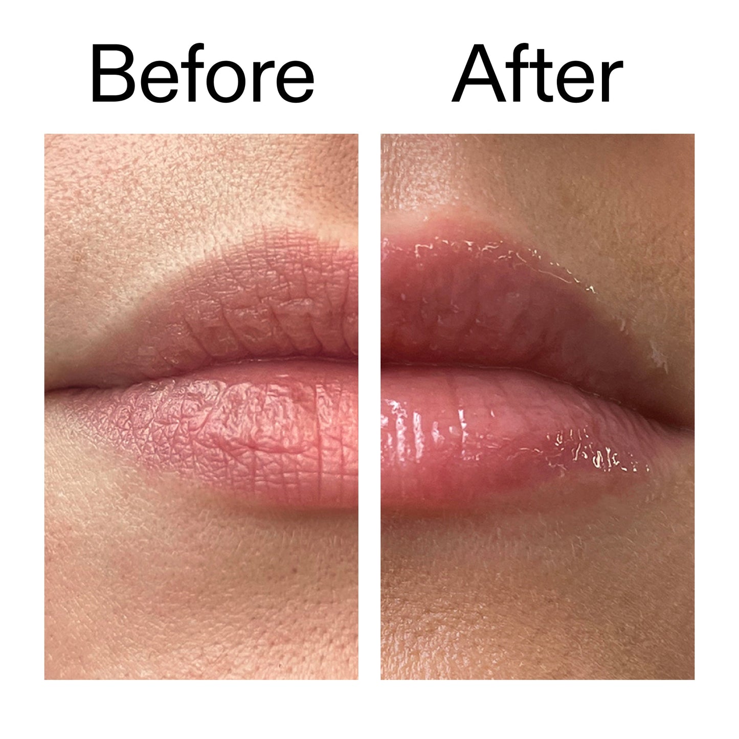 lip-plumping-duo-e3 Tripeptide_Plumping_Lip_Balm_Before_After_2000x2000_b4a5ee04-d2ac-4857-8f01-17209acc4bf3.jpg