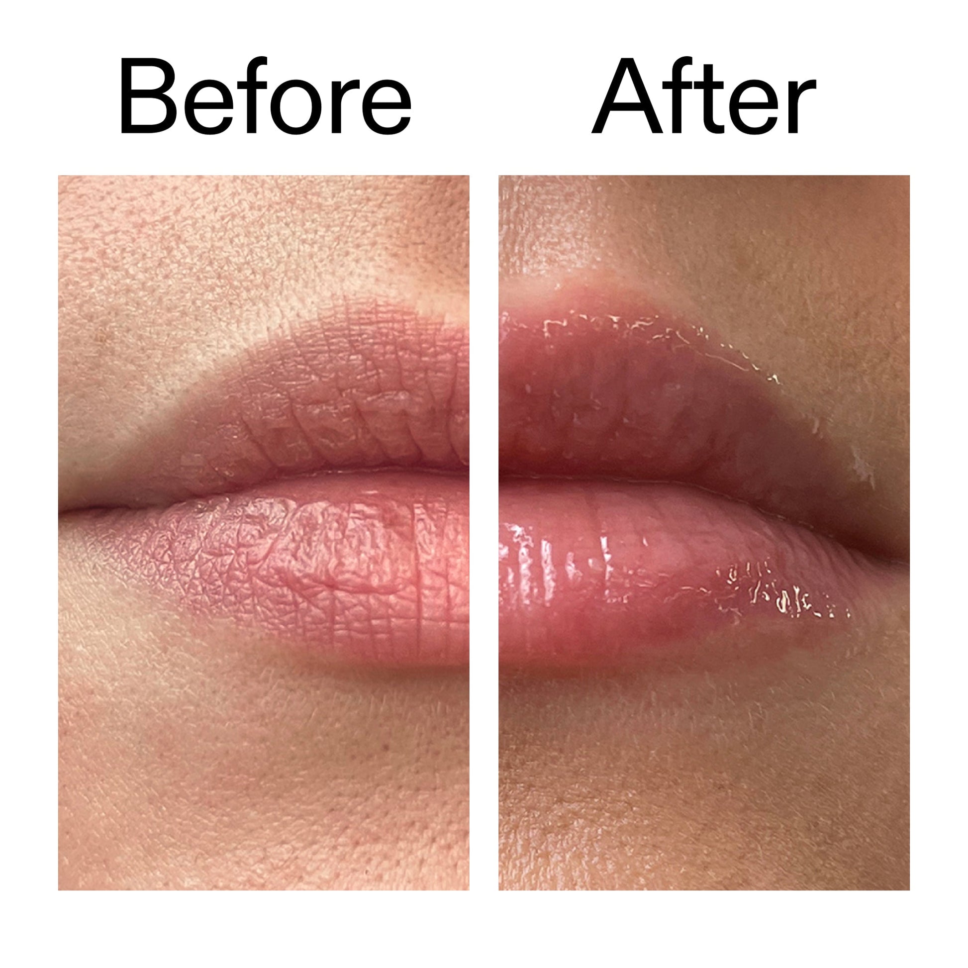 tripeptide-plumping-lip-balm-l8 Tripeptide_Plumping_Lip_Balm_Before_After_2000x2000_b4a5ee04-d2ac-4857-8f01-17209acc4bf3.jpg