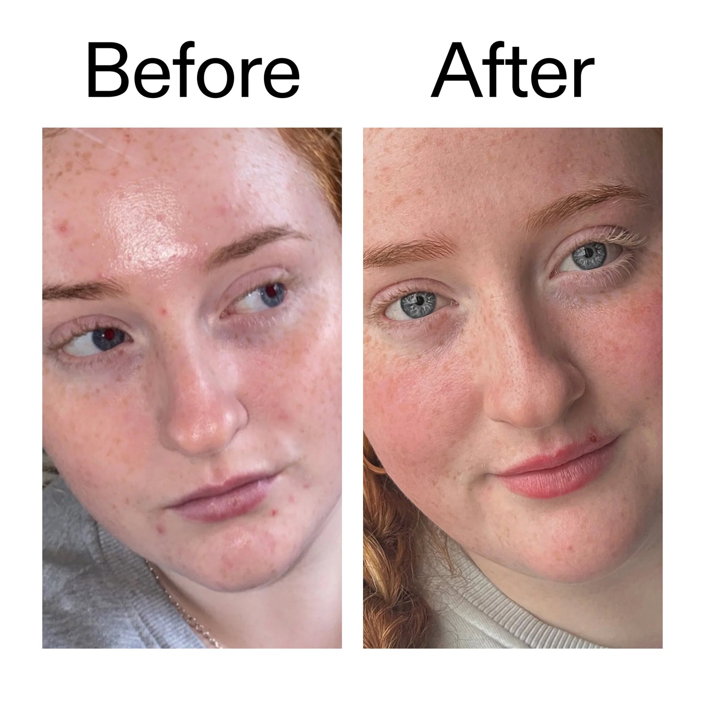 vitamin-b-c-and-e-moisturizer-x7 Vitamin_B_C_and_E_Moisturizer_Before_After_2000x2000_b0781a76-5ad2-4be9-95b8-ef92b356833c.jpg